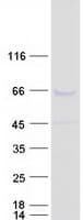Human MEIS2 Protein (Recombinant Myc-DDK (Flag))