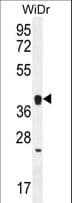 Polyclonal Rabbit anti-Human OR2T8 Antibody (aa241-269, WB)