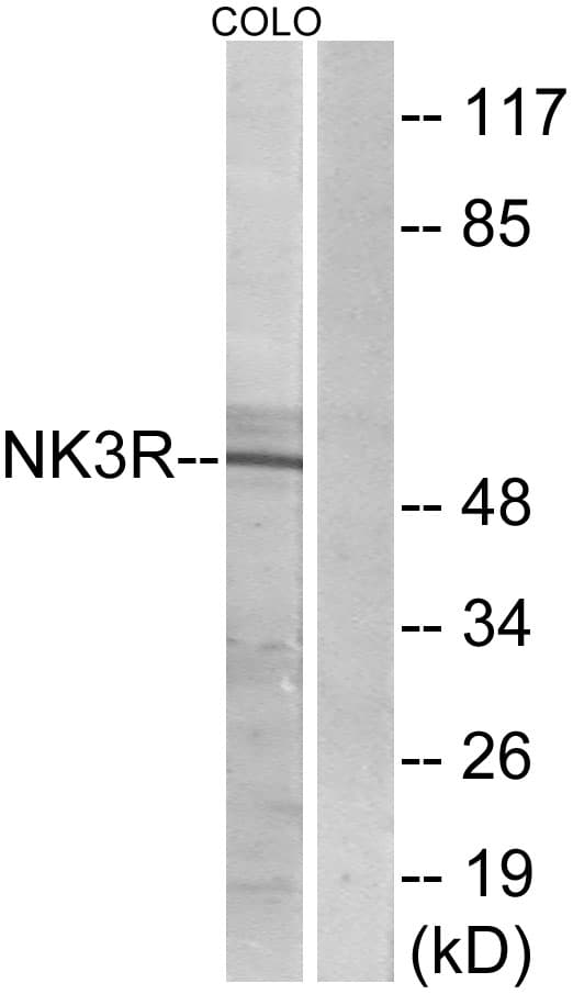 TACR3 / NK3R Antibody (aa401-450)
