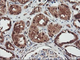 Monoclonal Mouse anti-Human NLN / Neurolysin Antibody (clone OTI3H4, IHC, WB)