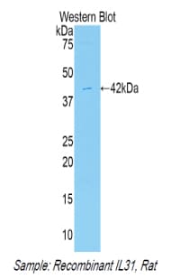 IL31 Antibody (aa25-156)