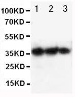 EPO / Erythropoietin Antibody (aa1-166)