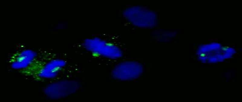 Polyclonal Rabbit anti-Human CDK5RAP2 Antibody (aa1843-C-term, IF)