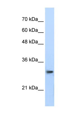 PSMA1 Antibody (aa170-219)