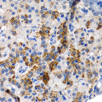 CYP24 / CYP24A1 Antibody