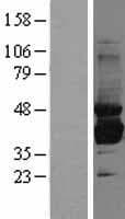 SORD / Sorbitol Dehydrogenase Protein (Over-Expression Lysate Myc-DDK (Flag))