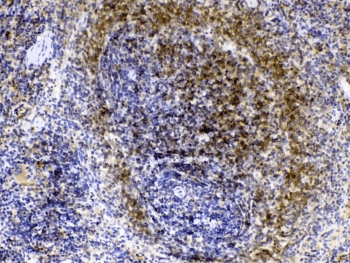 LYN Antibody