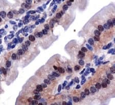 LOX / Lysyl Oxidase Antibody (aa78-115)