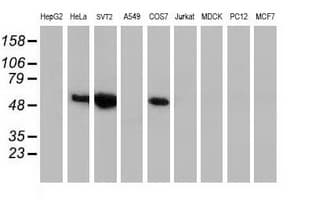 TP53 / p53 Antibody (clone OTI1D1)