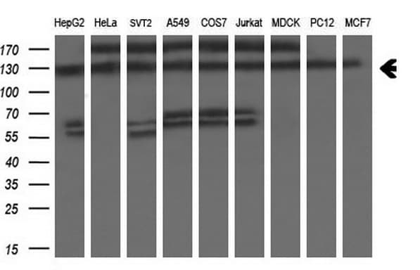 ZEB1 / AREB6 Antibody (aa1-350, clone OTI3G6)