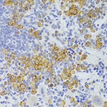 CD95 / FAS Antibody
