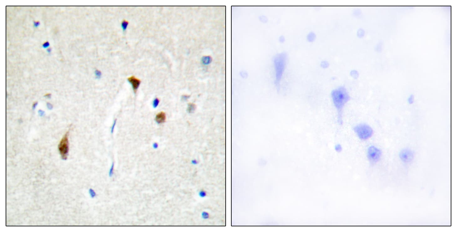 Hairless / HR Antibody (aa41-90)