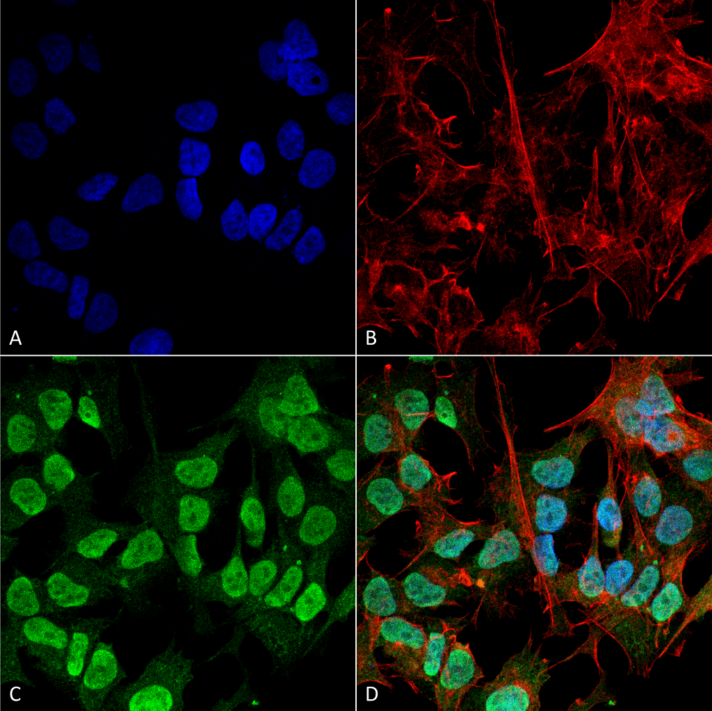 SNCA / Alpha-Synuclein Antibody (clone 3F8)