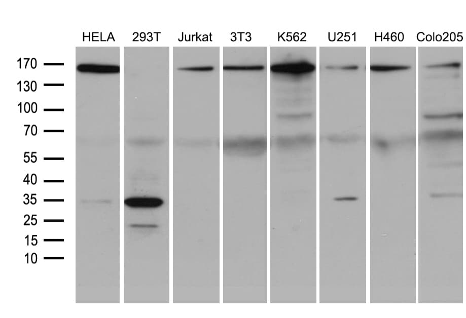SMC1A / SMC1 Antibody (aa889-1016, clone OTI3G4, Carrier-free)