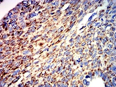 ATPIF1 / ATPI Antibody (clone 1F3B8)