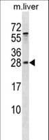 RAB5B Antibody (aa85-112)