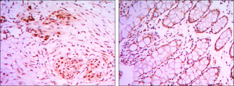 KDM4A / JHDM3A / JMJD2A Antibody (clone 5H1)