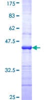 Human ERN1 / IRE1 Protein (Recombinant GST, N-terminus)