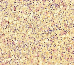 Polyclonal Rabbit anti-Human DOK2 Antibody (IHC, IF, WB)