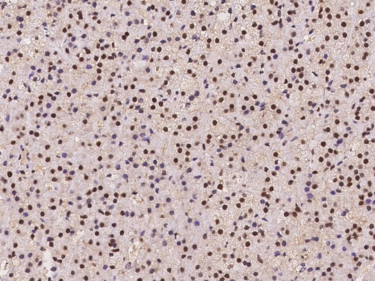 TRIM33 / TIF1-Gamma Antibody