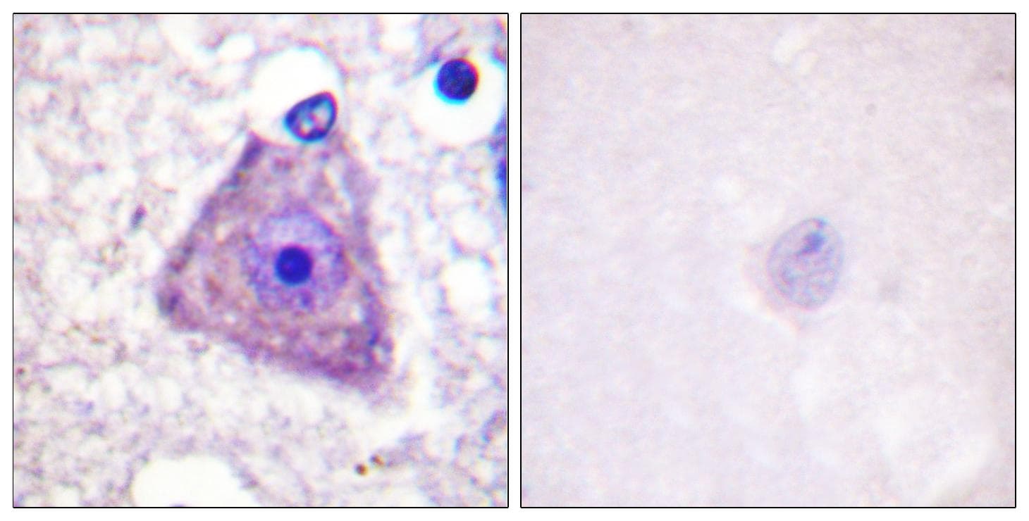 RASGRF1 / CDC25 Antibody (phospho-Ser916)