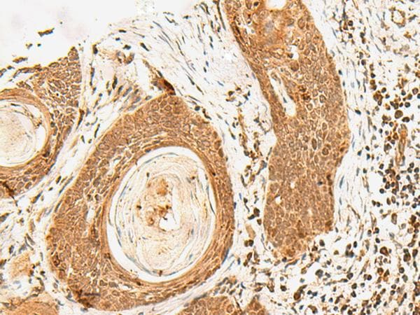 POLH / DNA Polymerase Eta Antibody