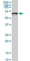 Monoclonal Mouse anti-Human SWAP70 Antibody (clone 3H8, IHC, WB)