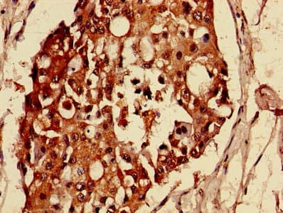 Polyclonal Rabbit anti-Human MAS1L / MRG Antibody (IHC, WB)