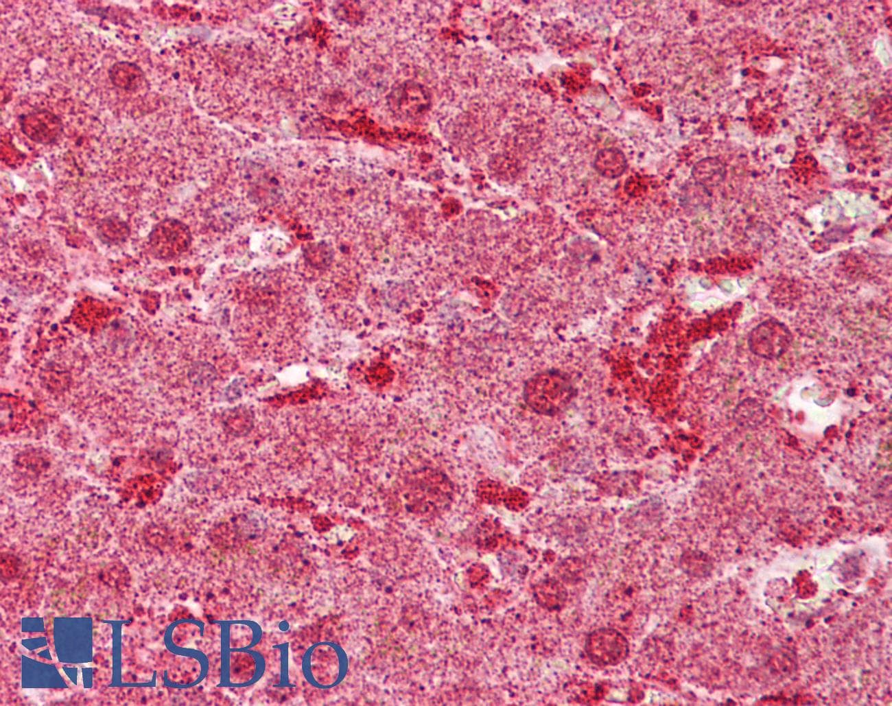 Polyclonal Rabbit anti-Human MST1 Antibody (aa540-589, IHC, WB)