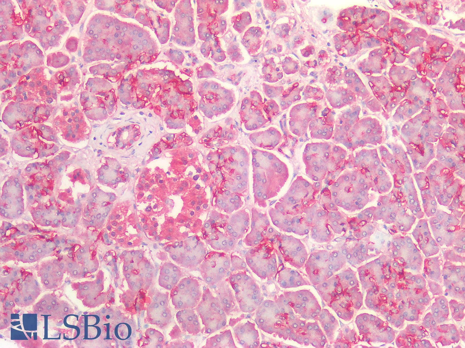 PathPlus™ TTR / Transthyretin Antibody