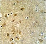 KLC2 Antibody (aa403-432)