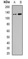 SMARCC1 / SWI3 Antibody