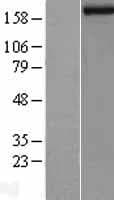 Human KDM5B / JARID1B Protein (Over-Expression Lysate Myc-DDK (Flag))