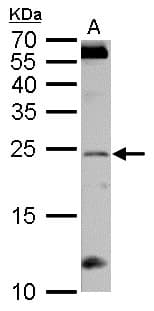RGS4 Antibody (aa1-205)