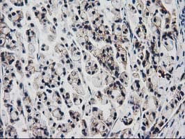 VCAM1 / CD106 Antibody (clone OTI3H10, Carrier-free)
