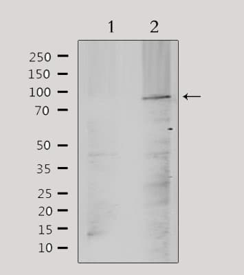 Polyclonal Rabbit anti-Human ANO9 / TMEM16J Antibody (IHC, IF, WB)