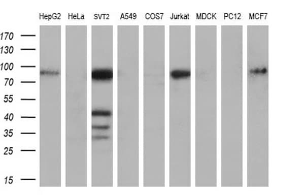 Monoclonal Mouse anti-Human MMP2 Antibody (clone OTI4B11, Carrier-free, aa228-507, WB)