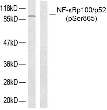 NFKB2 Antibody (phospho-Ser865)
