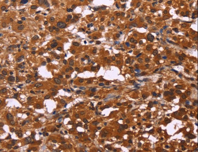Polyclonal Rabbit anti-Human ART5 Antibody (IHC)