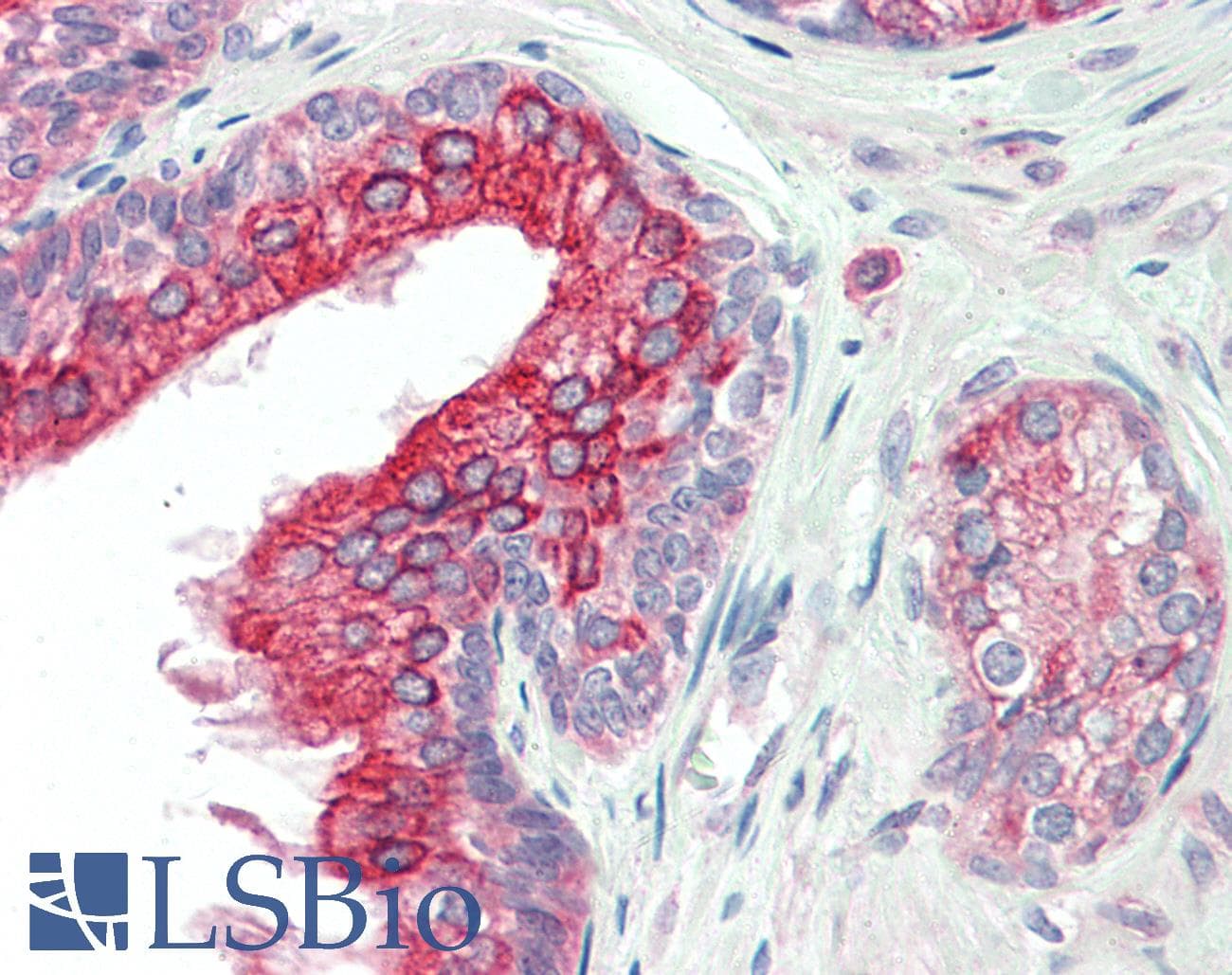 IHC-plus™ ANKK1 Antibody (aa482-496)