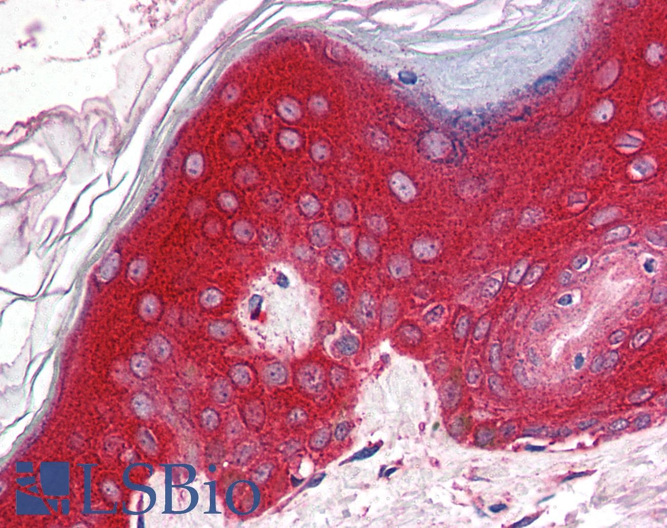IHC-plus™ Polyclonal Rabbit anti-Human PAK4 Antibody (IHC, IF, WB)