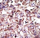 PTAR2 / FNTA Antibody (aa330-360)
