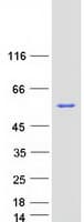 Human MTMR2 Protein (Recombinant Myc-DDK (Flag))