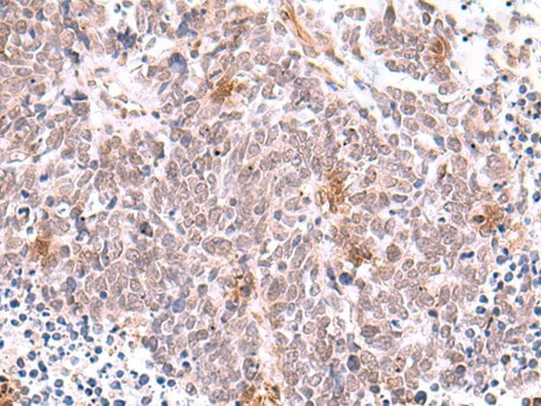 INPP5K / SKIP Antibody