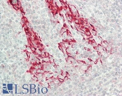 IHC-plus™ ANKK1 Antibody (290-370 aa, Internal)