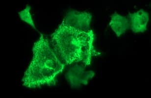 NEFM / NF-M Antibody (clone OTI2C4, Carrier-free)