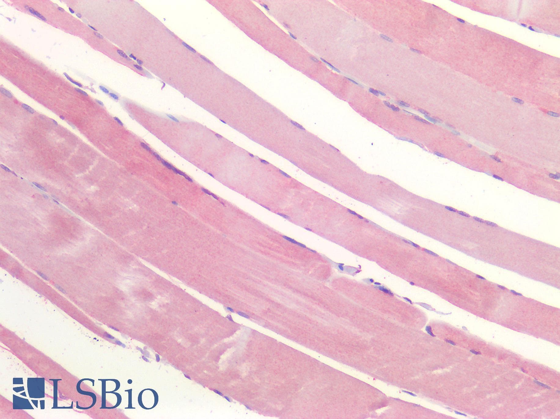 IHC-plus™ Polyclonal Rabbit anti-Human P2RX3 / P2X3 Antibody (IHC)