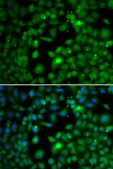 IHC-plus™ TFEB Antibody