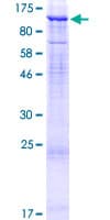 Human DCBLD2 Protein (Recombinant GST)