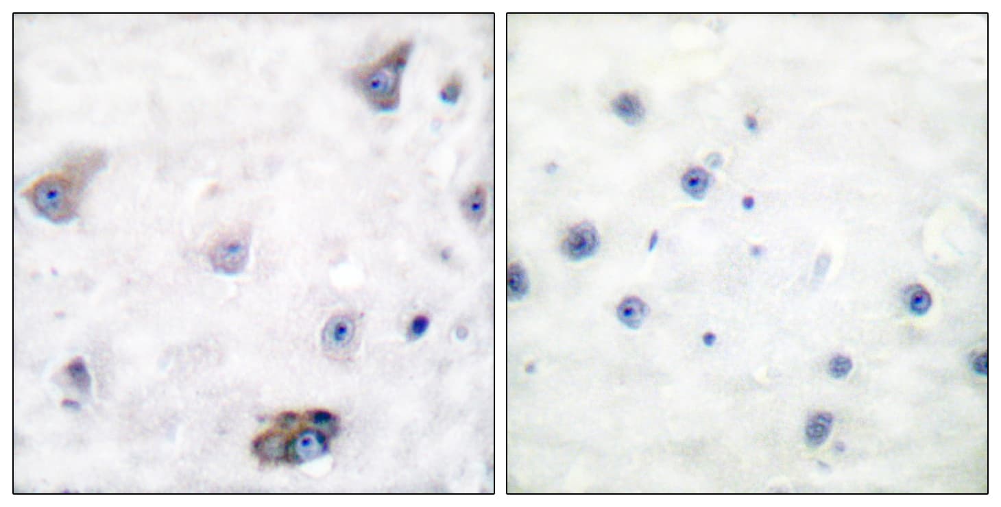 GABRB1 Antibody (phospho-Ser434)